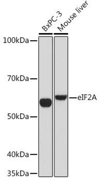 Anti-eIF2A Antibody (CAB9709)