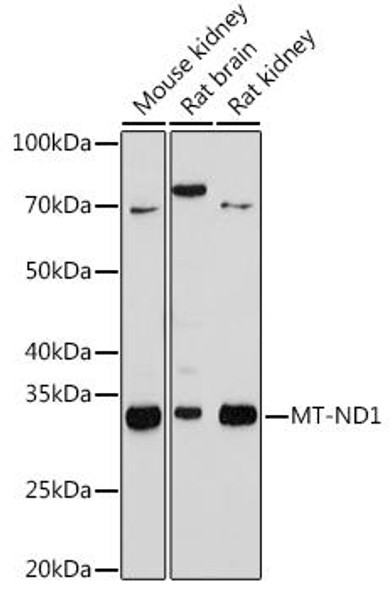 Anti-MT-ND1 Antibody (CAB9743)