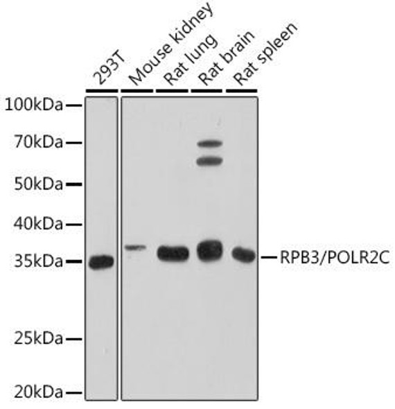 Anti-RPB3/POLR2C Antibody (CAB9744)