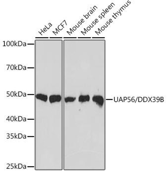 Anti-UAP56/DDX39B Antibody (CAB9749)