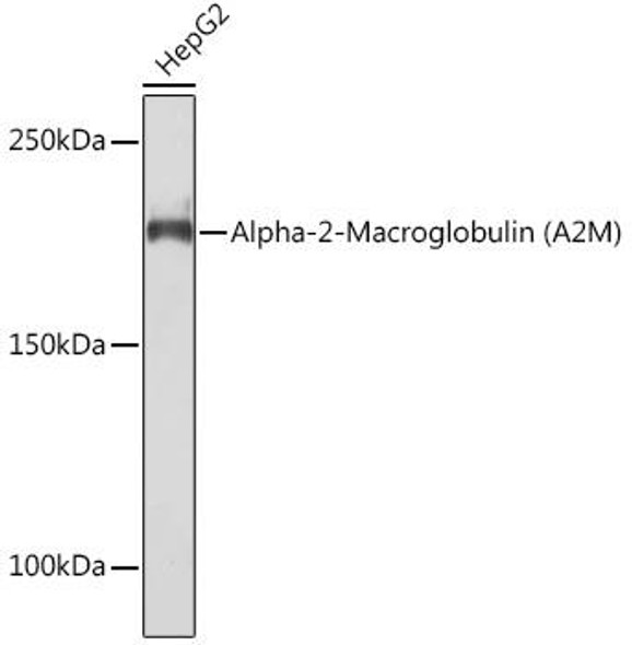 Anti-Alpha-2-Macroglobulin (A2M) Antibody (CAB9752)