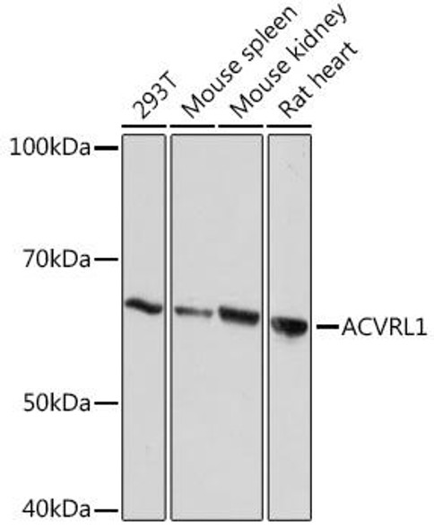 Anti-ACVRL1 Antibody (CAB9755)