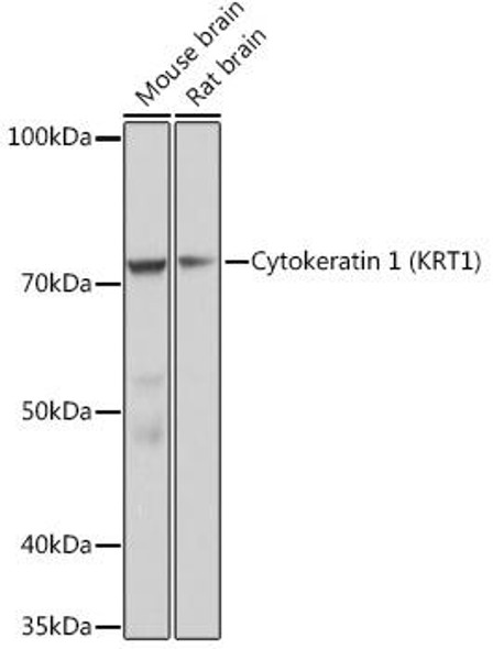 Anti-Cytokeratin 1 (KRT1) Antibody (CAB9776)