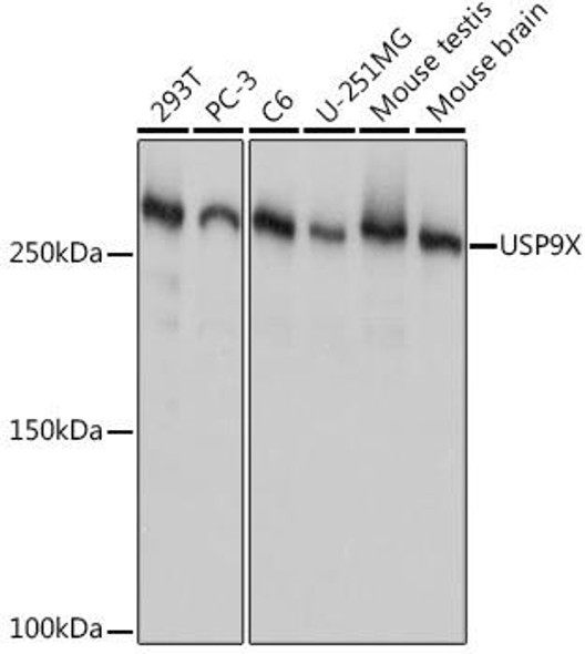 Anti-USP9X Antibody (CAB9782)