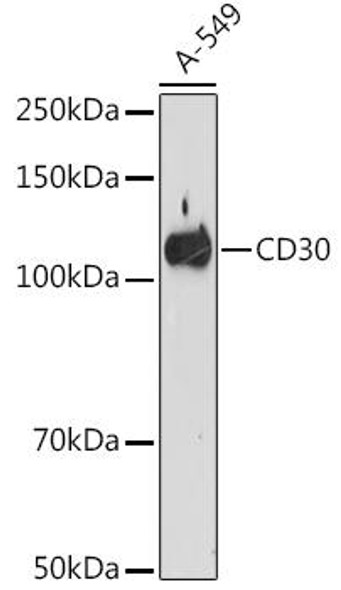 Anti-CD30 Antibody (CAB9789)