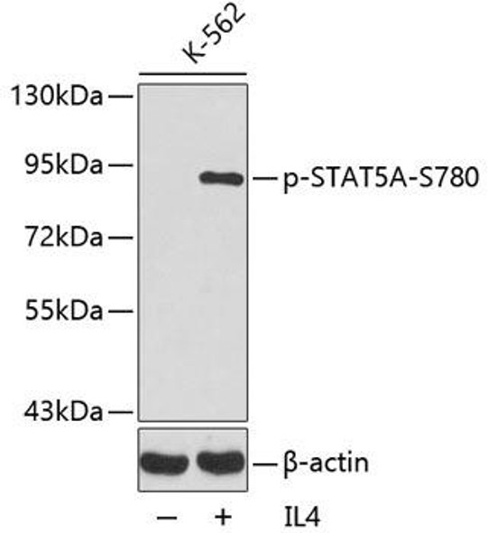 Anti-Phospho-STAT5A-S780 Antibody (CABP0139)