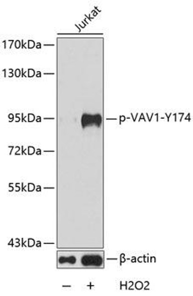 Anti-Phospho-VAV1-Y174 Antibody (CABP0180)