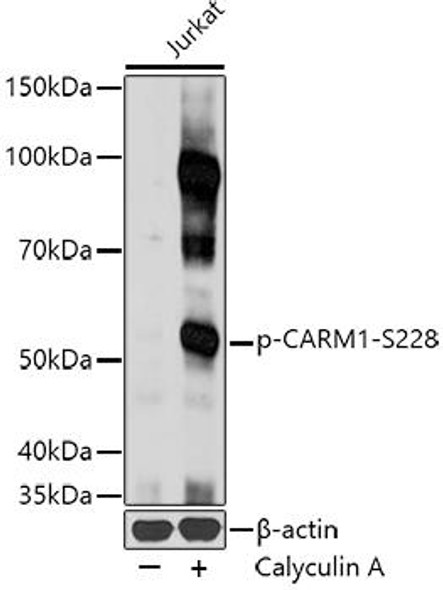 Anti-Phospho-CARM1-S228 Antibody (CABP0319)
