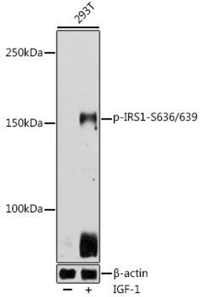 Anti-Phospho-IRS1-S636/639 Antibody (CABP0551)