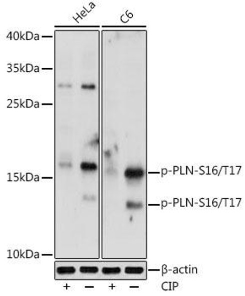 Anti-Phospho-PLN-S16/T17 Antibody (CABP0956)