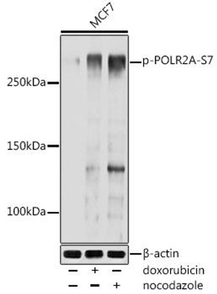Anti-Phospho-POLR2A-S7 Antibody (CABP0969)