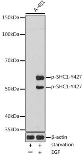 Anti-Phospho-SHC1-Y427 Antibody (CABP1184)