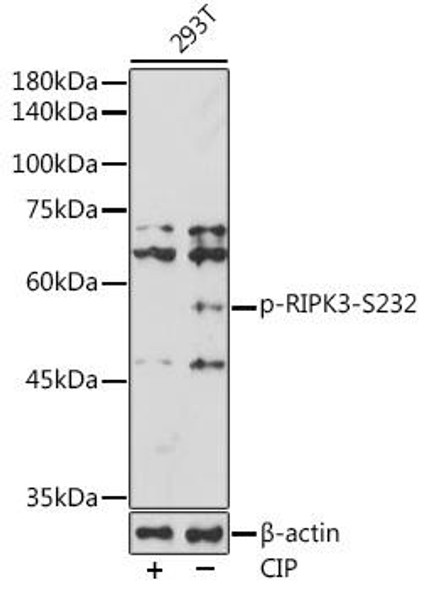 Anti-Phospho-RIPK3-S232 Antibody (CABP1185)