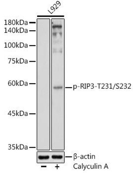 Anti-Phospho-RIP3-T231/S232 Antibody (CABP1260)