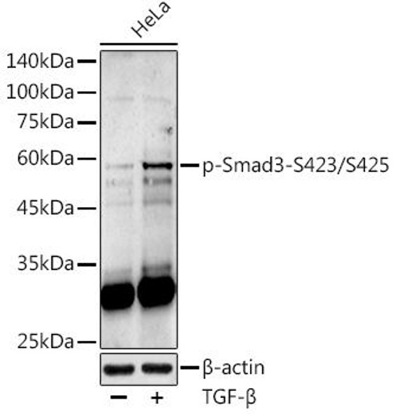 Anti-Phospho-Smad3-S423/S425 Antibody (CABP1263)
