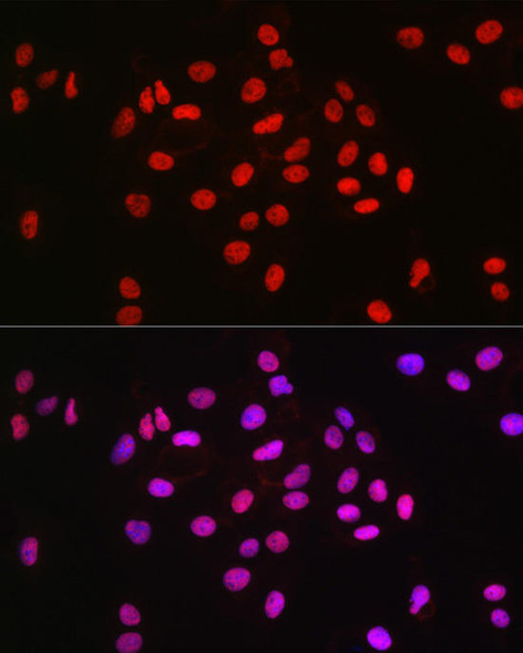 Anti-MCM2 Antibody (CAB20699)