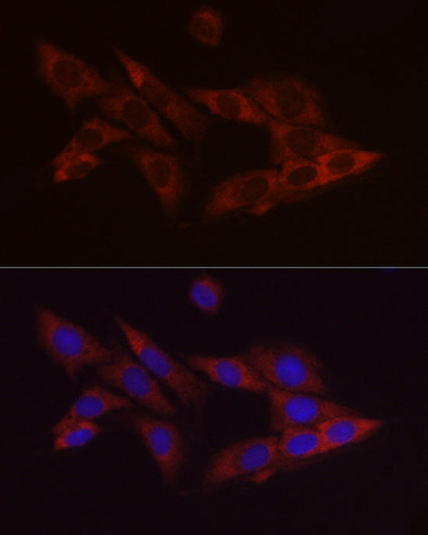 Anti-Bcl 2 Mouse Antibody (CAB20777)