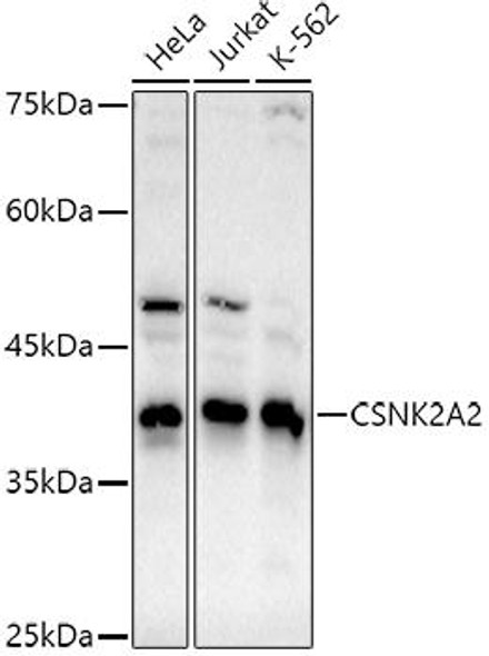 Anti-CSNK2A2 Antibody (CAB20791)