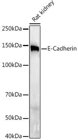 Anti-E-Cadherin Antibody (CAB20798)