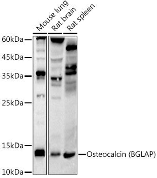 Anti-Osteocalcin (BGLAP) Antibody (CAB20800)