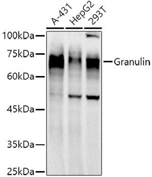 Anti-Granulin Antibody (CAB20806)