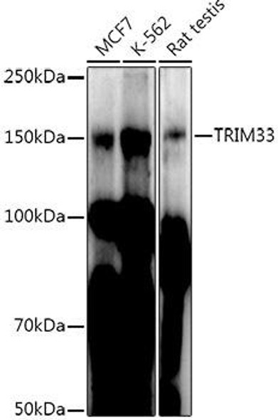 Anti-TRIM33 Antibody (CAB20811)