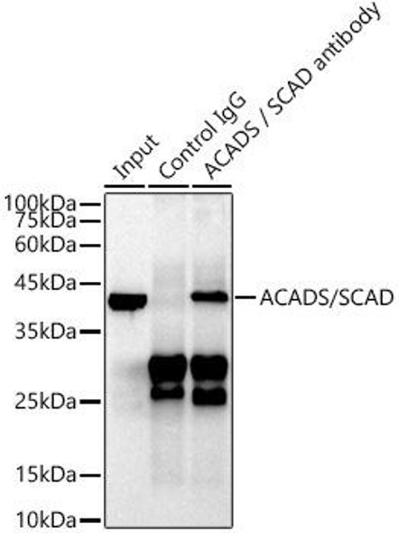 Anti-ACADS / SCAD Antibody (CAB20926)