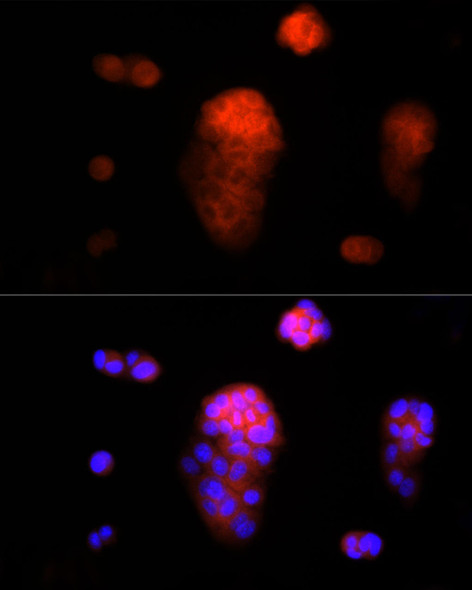 Anti-AAMP Antibody (CAB20970)