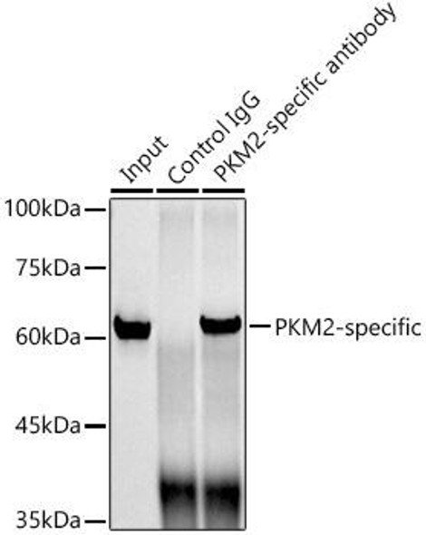 Anti-PKM2-specific Antibody (CAB20991)