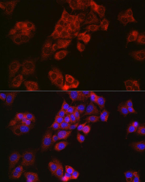 Anti-Niemann Pick C1 Antibody (CAB4795)