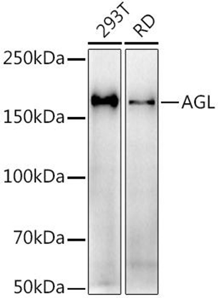 Anti-AGL Antibody (CAB9353)
