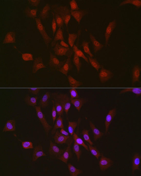 Anti-TAF15 Antibody (CAB9383)