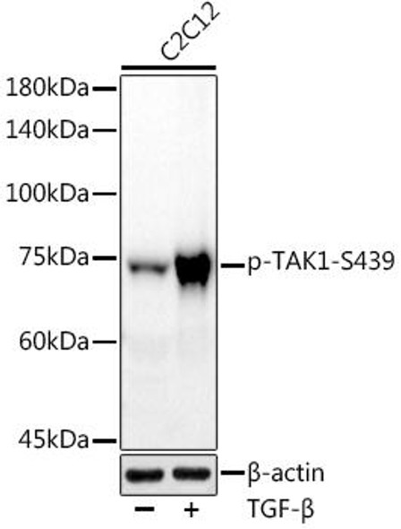 Phospho-TAK1-S439 Antibody (CAB9437)