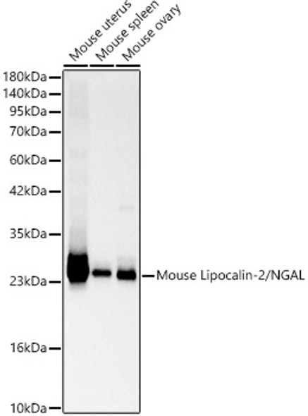Lipocalin-2/NGAL Polyclonal Antibody