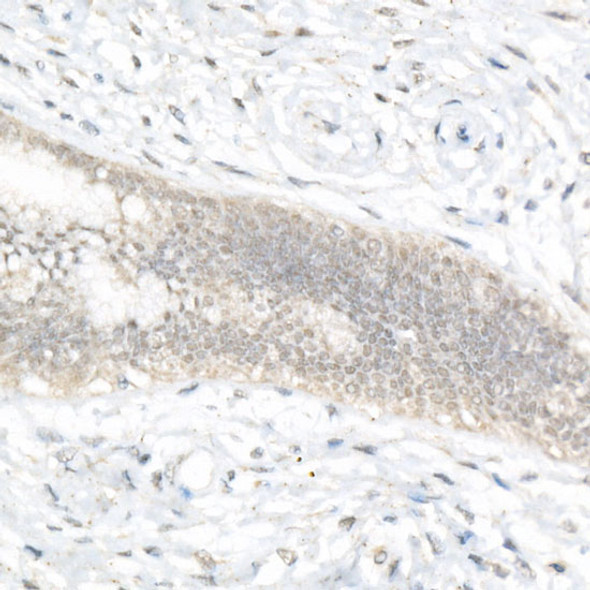 FOXQ1 Polyclonal Antibody