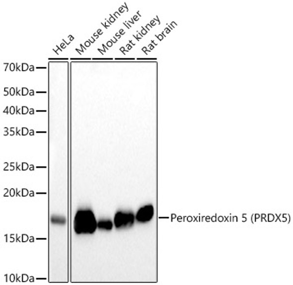 Peroxiredoxin 5 (PRDX5) Monoclonal Antibody