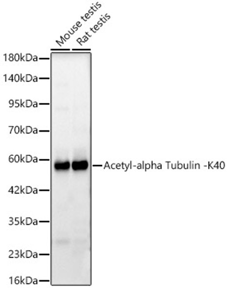 Acetyl-alpha Tubulin -K40 Monoclonal Antibody