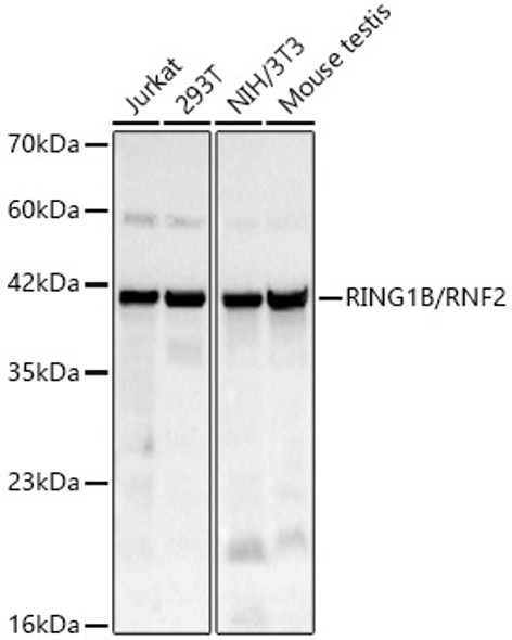 RING1B/RNF2 Monoclonal Antibody