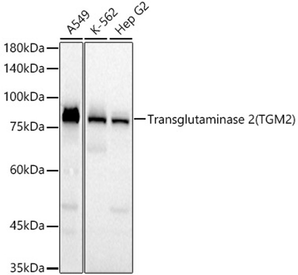 Transglutaminase 2 (TGM2) Monoclonal Antibody