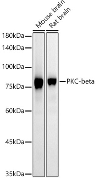 PKC-beta Monoclonal Antibody