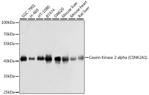 Casein Kinase 2 alpha (CSNK2A1) Polyclonal Antibody