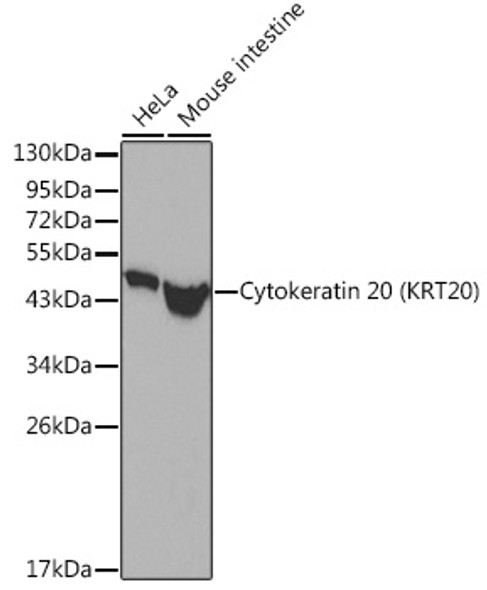 Cytokeratin 20 (KRT20) Polyclonal Antibody