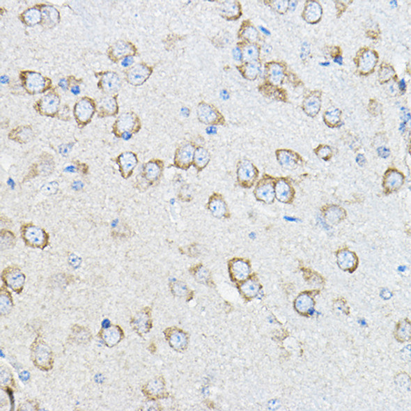 STIM1 Polyclonal Antibody