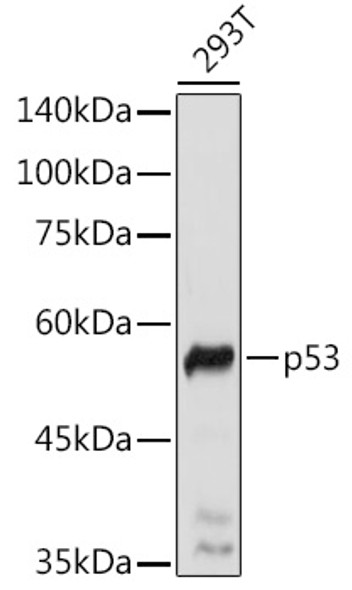 p53 Polyclonal Antibody (CAB21630)