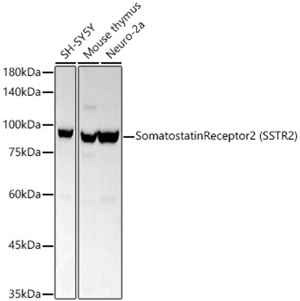 Somatostatin Receptor 2 (SSTR2) Monoclonal Antibody (CAB21970)