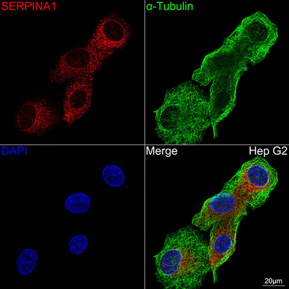 Alpha-1 Antitrypsin (SERPINA1) Monoclonal Antibody