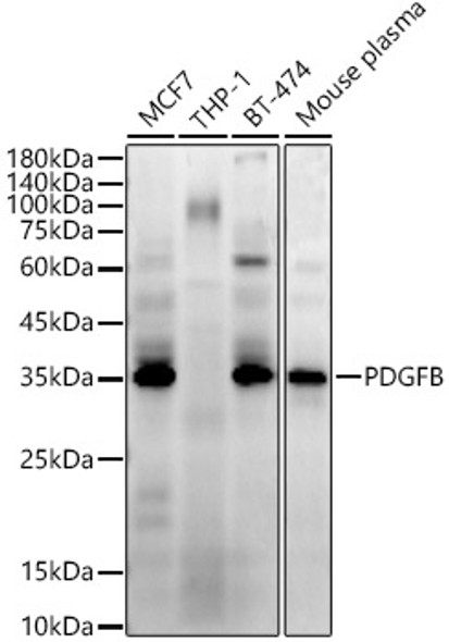 PDGFB Monoclonal Antibody (CAB22035)