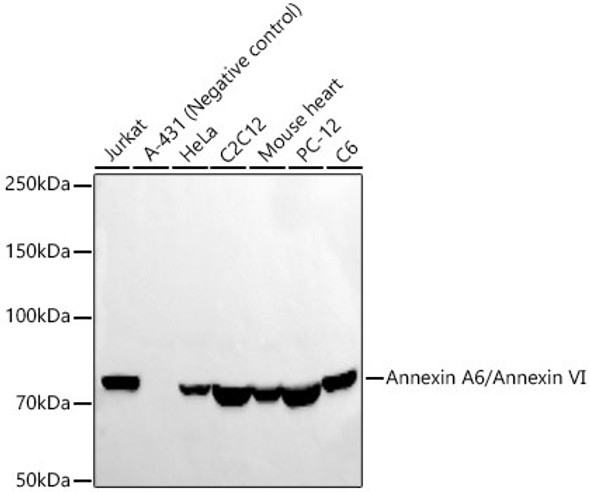 Annexin A6/Annexin VI Monoclonal Antibody