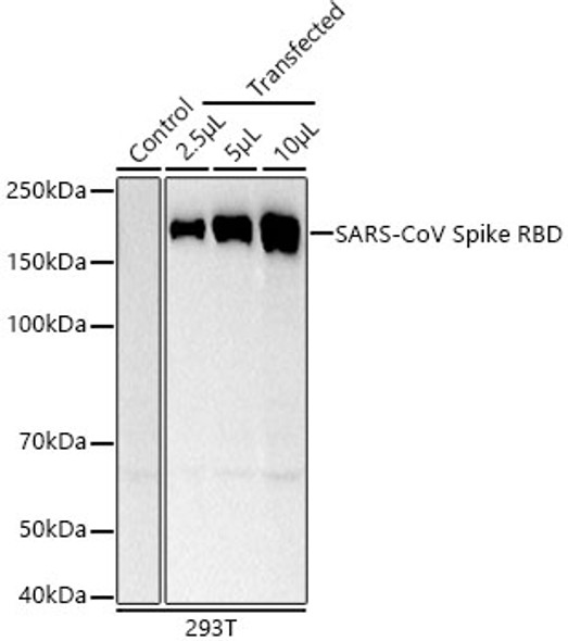SARS-CoV Spike RBD Monoclonal Antibody (CAB22368)