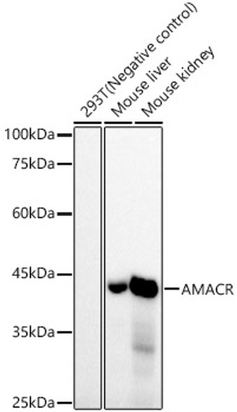 AMACR/p504S Monoclonal Antibody